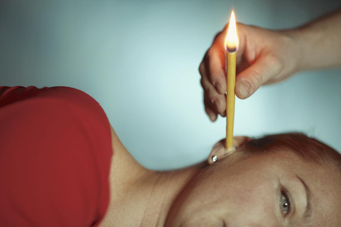 Ear Candling One Ear